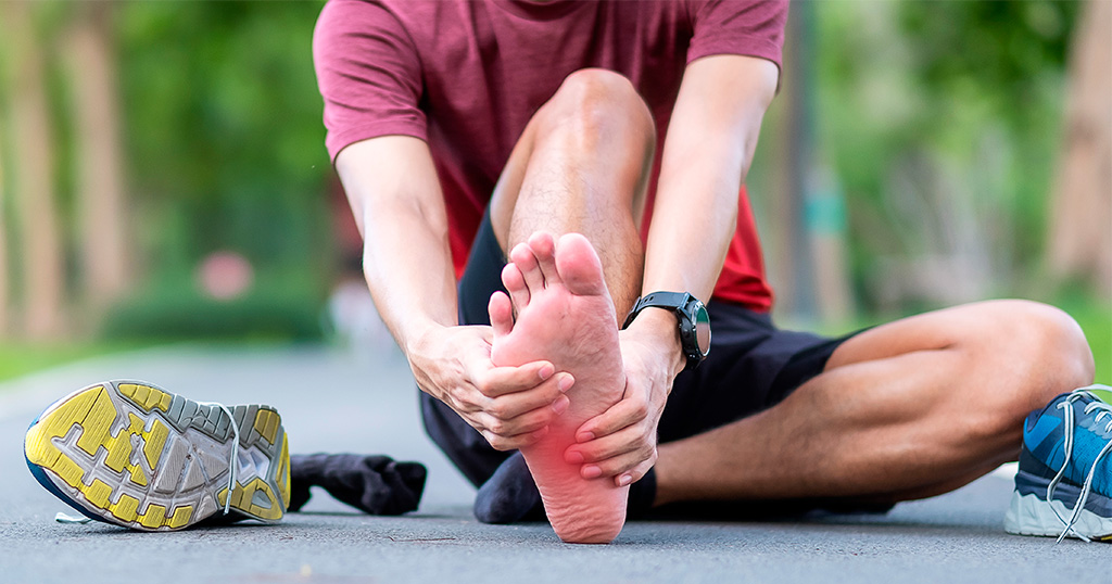 Ilustración de la fascitis plantar mostrando inflamación en la fascia del pie y dolor en el talón