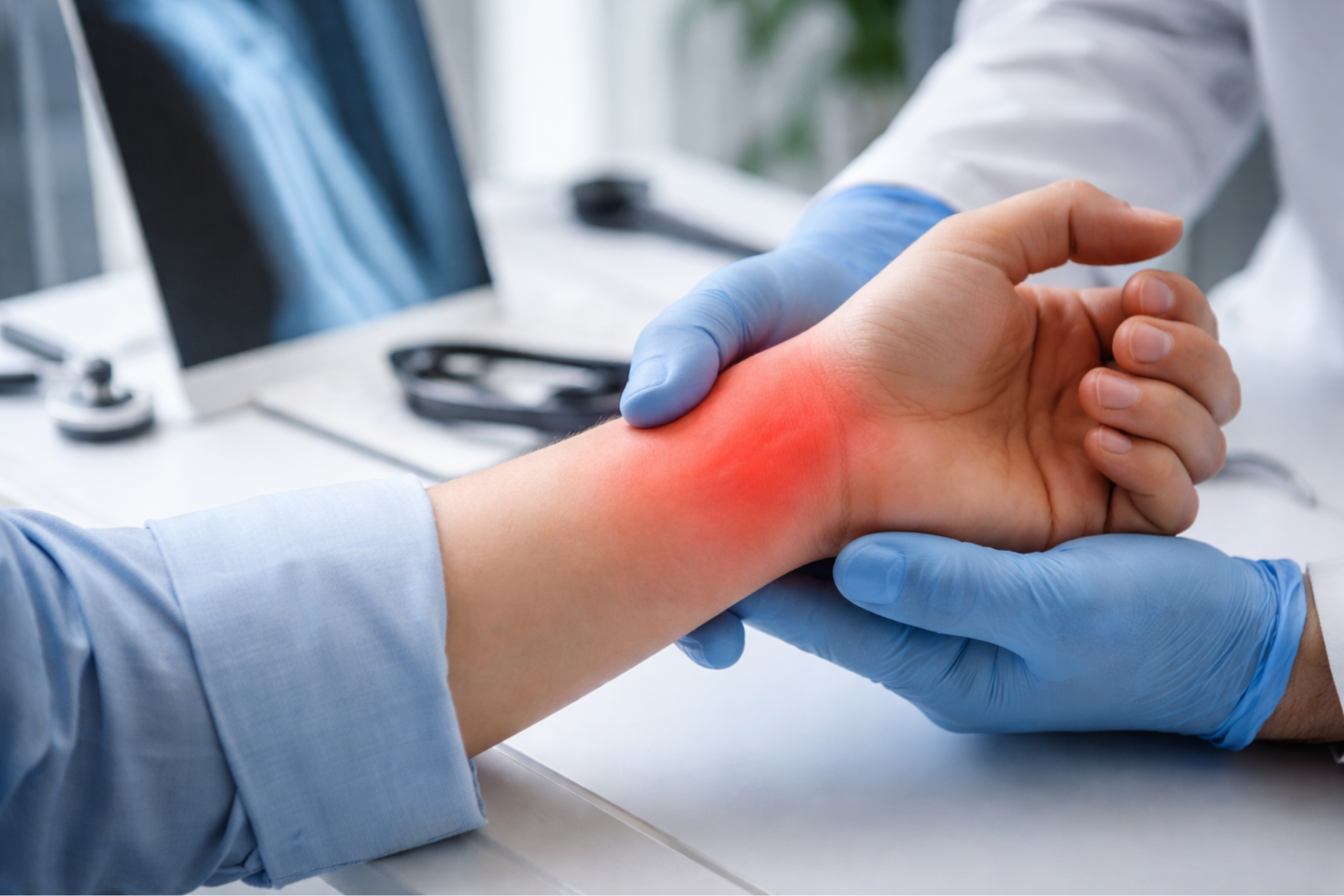 Muñeca con dolor resaltado en rojo siendo evaluada por médico